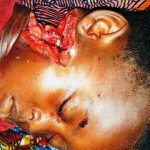 Little Catherine, savagely mutilated in October 2013.